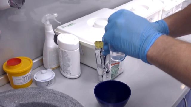 Создание слепка из альгинатной массы «Белопринт», ВЛАДМИВА смотреть онлайн