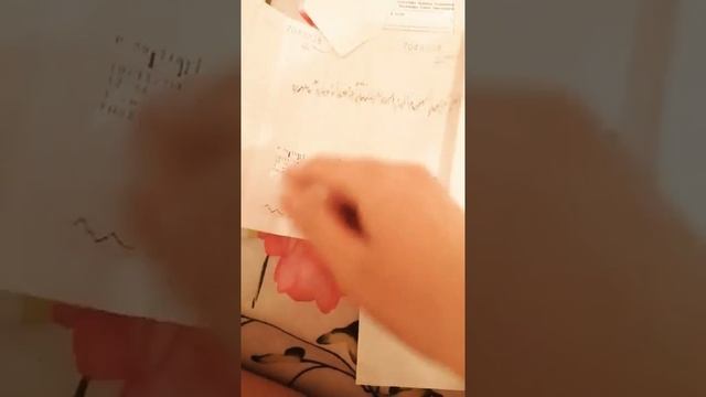расшифровка ктг на моем примере как распознать гипоксию плода тонус матки схватки смотреть онлайн