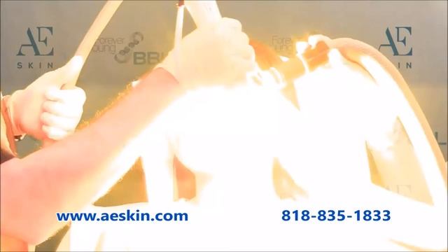 Forever Young BBL IPL Photofacial Demonstration 38 - A E Skin - Encino, CA - 818-835-1833 смотреть онлайн