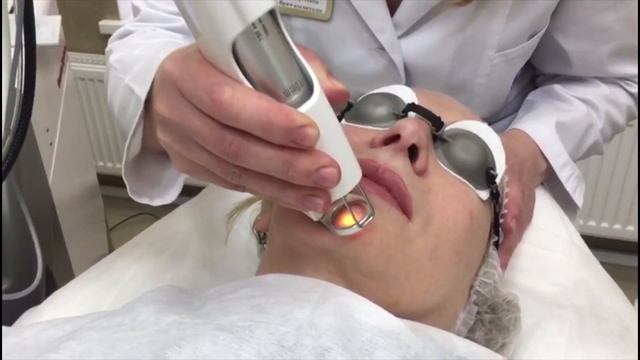 Уход за лицом. Глубокое дермальное омоложение