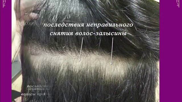 Ужасы наращивания волос и неправильного ухода. смотреть онлайн