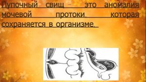 ШОК! ВОНЬ ИЗ ПУПКА! Причины, симптомы и решение проблемы!