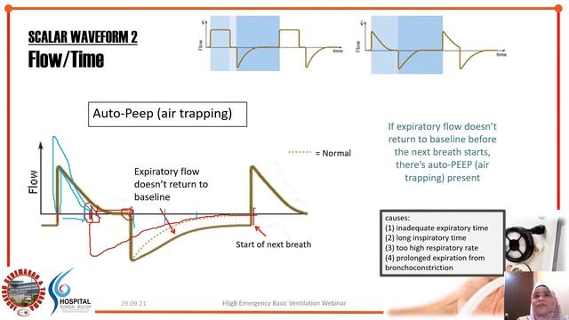 Lecture 8 Ventilator Waveforms смотреть онлайн