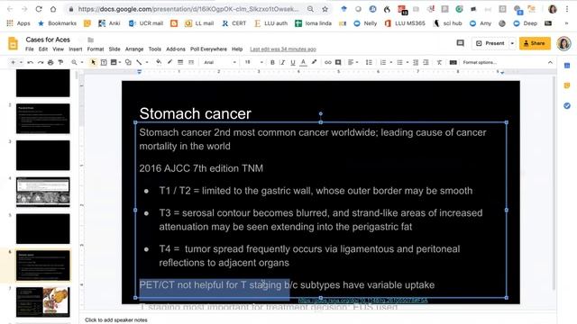 Gastric cancer nodal staging update (Nelly Tan) смотреть онлайн