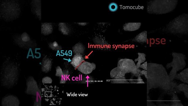 Natural Killer Cell Killing Cancer смотреть онлайн