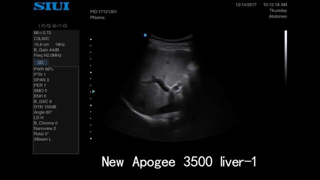 SIUI Apogee 3500 Örnek Görüntüler смотреть онлайн