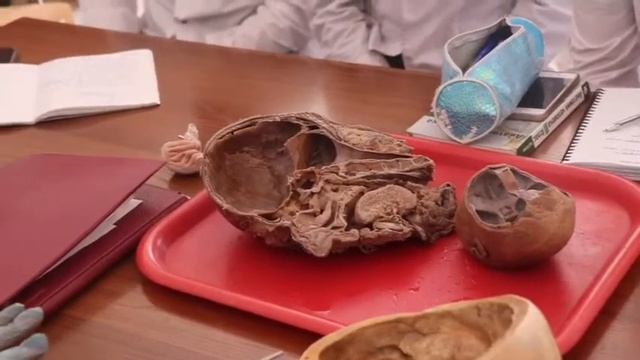 Внутренной мозг. ລະບົບພາຍໃນຂອງສະຫມັນ смотреть онлайн