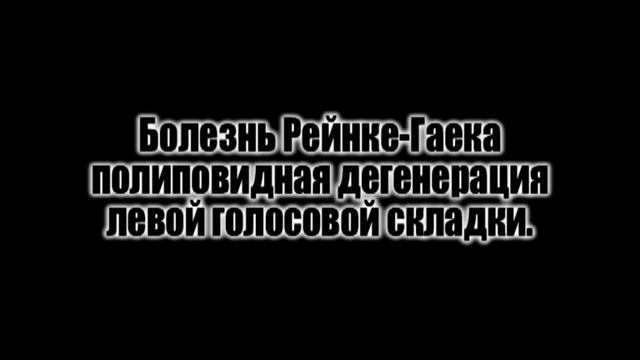 Заболевания гортани смотреть онлайн