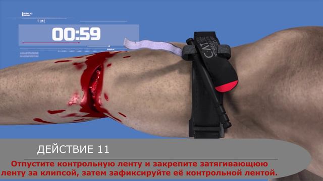 ВМП. Красная зона, жгут, огонь.