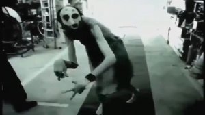 НЕ ДЛЯ СЛАБО НЕРВНЫХ!!! САМОЕ СТРАШНОЕ ВИДЕО!!!(синдром марфана)