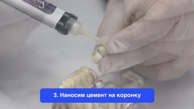 Новинка! Цемент для постоянной фиксации Supercem. смотреть онлайн