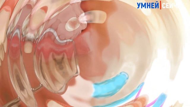 Боремся с Кариесом в домашних условиях! смотреть онлайн