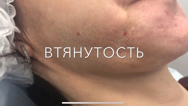 Урок красоты №35. Какие  и почему возникают осложнения в косметологии?