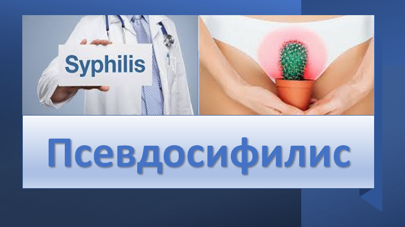 Псевдо сифилис смотреть онлайн