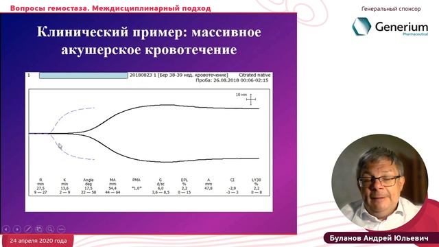 Метод тромбоэластографии в системе контроля гемостаза, Буланов А.Ю. смотреть онлайн