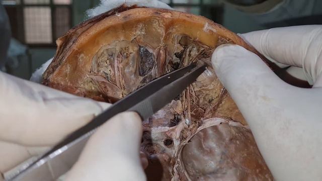 Dissection of Orbit смотреть онлайн