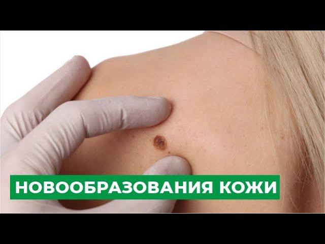 Новообразования кожи смотреть онлайн