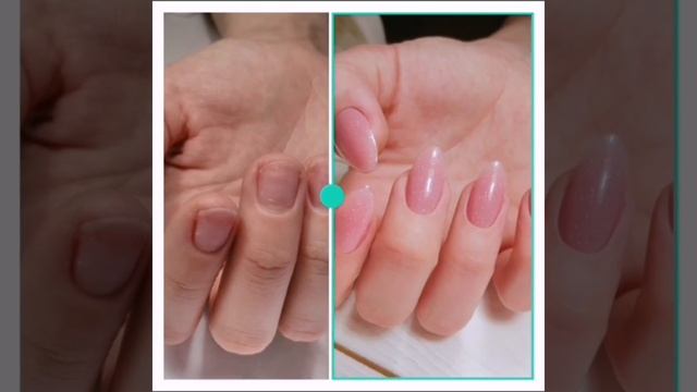 Наращивание ногтей До/После смотреть онлайн