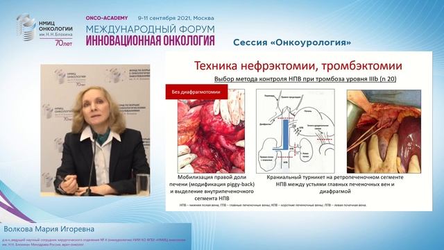 Рак почти с опухолевым венозным тромбозом: простые решения сложных задач. смотреть онлайн