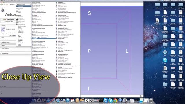 1B Download 3D Slicer, Plus Extensions смотреть онлайн