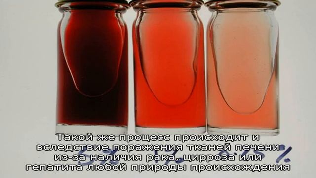 Причины образования мочи очень темного цвета у мужчин смотреть онлайн