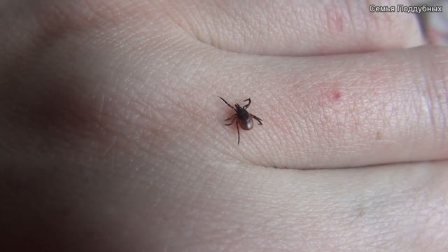 Как вытащить клеща Если укусил клещ Эксперимент над клещем How to pull a tick Поддубные смотреть онлайн