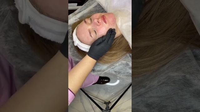 Протокол процедуры пилинг PRX-T33 смотреть онлайн