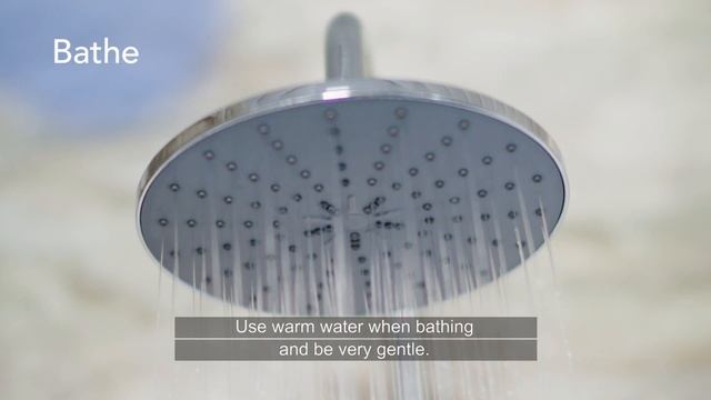 How to relieve hives at home смотреть онлайн