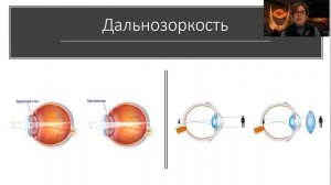 Дефекты зрения. 9 Класс.