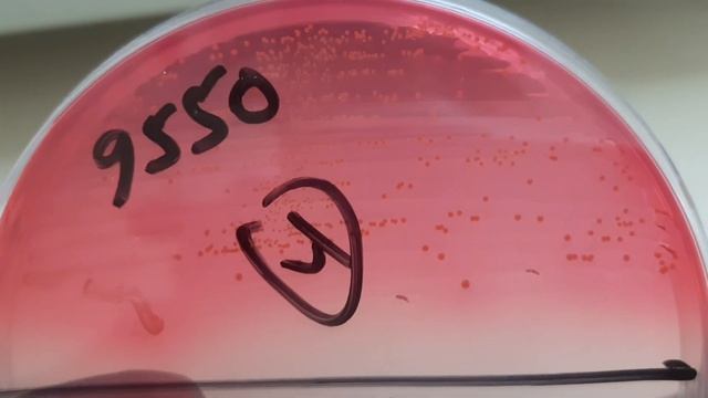 Enterococcus faecium Colony Morphology and Microscopy смотреть онлайн