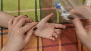 Как удалить бородавку - Я знаю способ 100%