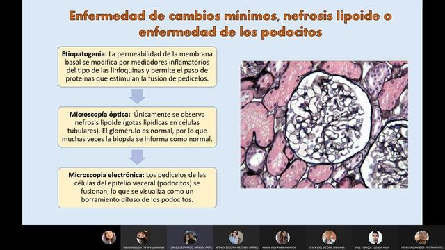 GRUPO N°4_10A_TEMA GLOMERULONEFRITIS смотреть онлайн