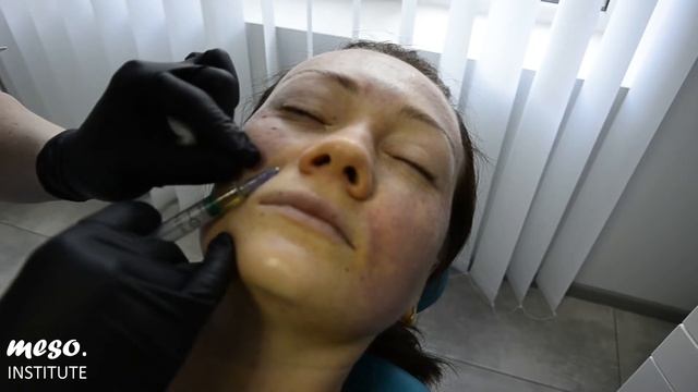 Особенности мезотерапевтического ухода весной от Meso Institute (Испания)