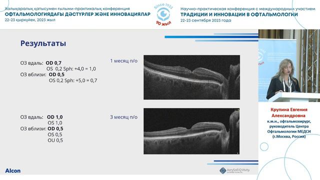 Патология макулы – не приговор с линзой AcrySof IQ Vivity смотреть онлайн
