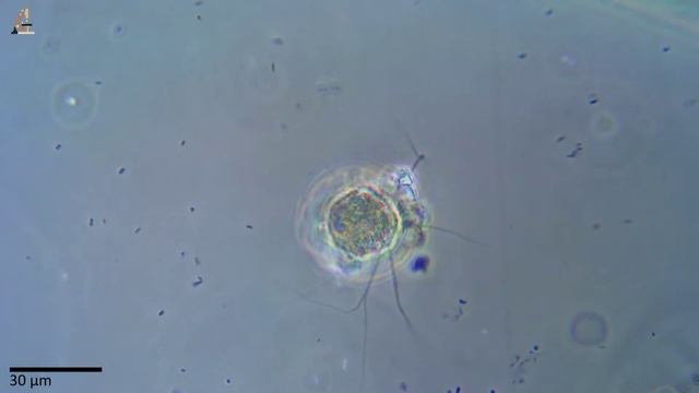 Раковинная амёба Псевдодиффлюгия (Testate Amoeba Pseudodifflugia)
