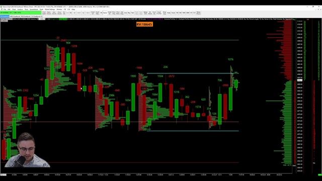 3 Settings You Must Change If Using Sierra Chart смотреть онлайн
