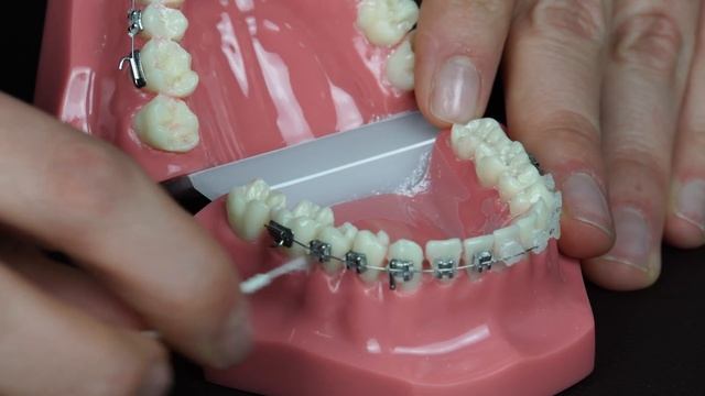How to Floss with Braces смотреть онлайн