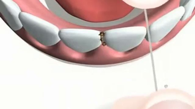 Зубная нить (флосс) Miradent Mirafloss® невощеная смотреть онлайн