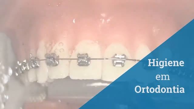 Video de Apresentação DENTVAP 2019 смотреть онлайн