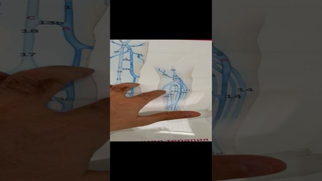 Варикоза нет. Узи сосудов. Флеболог Москва. Сосудистый хирург Москва. Флеболог. смотреть онлайн