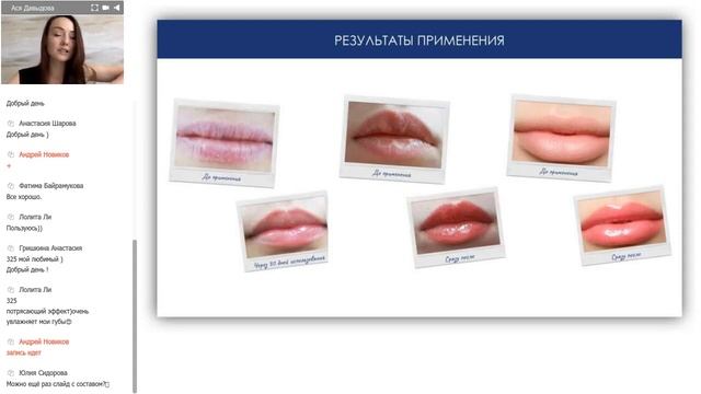 Luscious Lips (Лашес Липс, Infracyte) - Первое в мире antiage средство для объема и молодости губ! смотреть онлайн