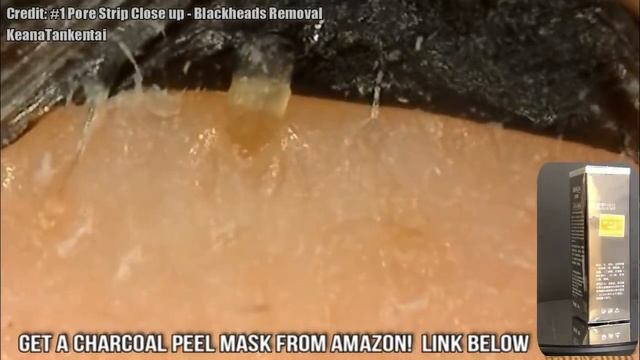 Pimple Popping - Under the Microscope! смотреть онлайн