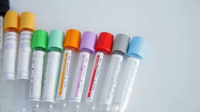 best supplier of prp tube смотреть онлайн