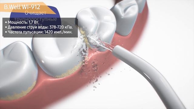 Ирригатор B.Well WI-912 смотреть онлайн