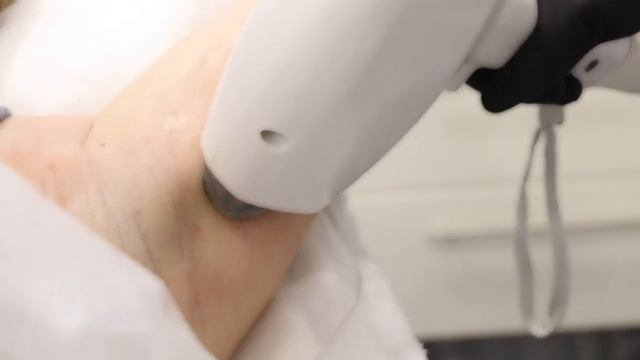 Лазерная эпиляция в Санкт-Петербурге смотреть онлайн