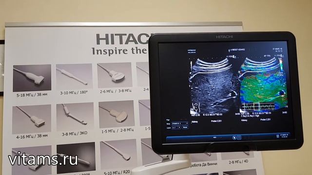 Hitachi Arietta 70 смотреть онлайн