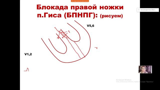 4 день школы ЭКГ #лекции #экг  #блокады #диагностика