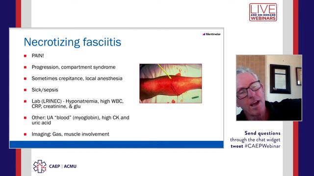 Receding Margins: Optimized Management of Skin and Soft Tissue Infections in the ED смотреть онлайн