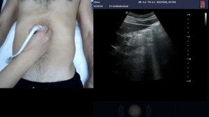 УЗИ органов брюшной полости с демонстрацией установки датчика.