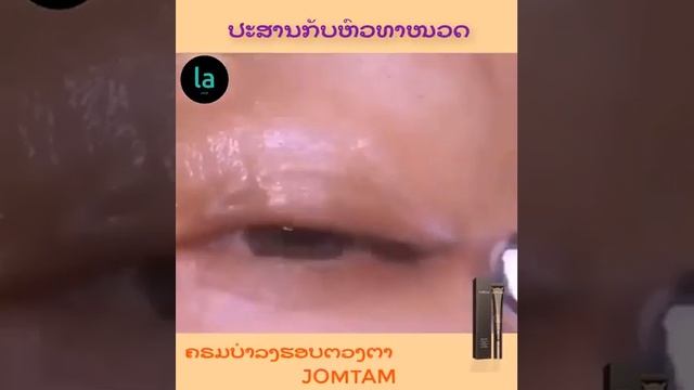 ຄຣີມບຳລຸ່ງຮອບຕວງຕາ JOMTAM смотреть онлайн